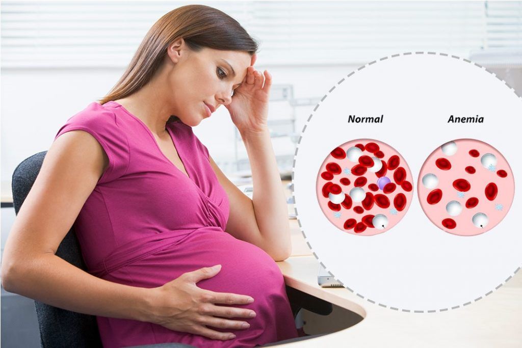 Anemia